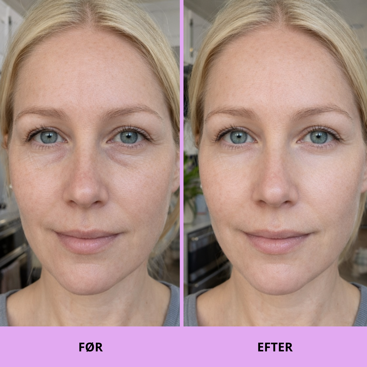 K-Beauty Peptide & Caffeine Eye Pads – Reducerer hævelser og fugter på 10 minutter